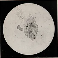 An illustration from Phenomena of materialisation : a contribution to the investigation of mediumistic teleplastics / by Baron von Schrenck Notzing ; translated by E.E. Fournier d'Albe. (1923)