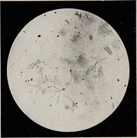 Picture 84 of 127 from Phenomena of materialisation : a contribution to the investigation of mediumistic teleplastics / by Baron von Schrenck Notzing ; translated by E.E. Fournier d'Albe. (1923), leaf 394