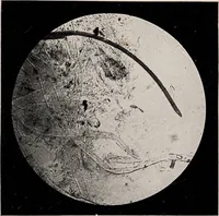 An illustration from Phenomena of materialisation : a contribution to the investigation of mediumistic teleplastics / by Baron von Schrenck Notzing ; translated by E.E. Fournier d'Albe. (1923)