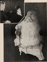 Picture 109 of 127 from Phenomena of materialisation : a contribution to the investigation of mediumistic teleplastics / by Baron von Schrenck Notzing ; translated by E.E. Fournier d'Albe. (1923), leaf 491