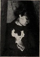 An illustration from Phenomena of materialisation : a contribution to the investigation of mediumistic teleplastics / by Baron von Schrenck Notzing ; translated by E.E. Fournier d'Albe. (1923)