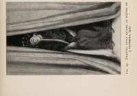 Picture 13 of 127 from Phenomena of materialisation : a contribution to the investigation of mediumistic teleplastics / by Baron von Schrenck Notzing ; translated by E.E. Fournier d'Albe. (1923), leaf 99
