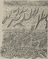 An illustration from A text-book of pathology / by Alfred Stengel ; with 394 illustrations in the text, many of them in colors, and 7 full-page chromolithographic plates. (1903)