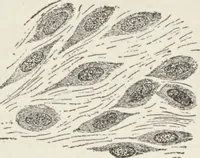 An illustration from A text-book of pathology / by Alfred Stengel ; with 394 illustrations in the text, many of them in colors, and 7 full-page chromolithographic plates. (1903)