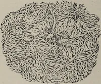 An illustration from A text-book of pathology / by Alfred Stengel ; with 394 illustrations in the text, many of them in colors, and 7 full-page chromolithographic plates. (1903)