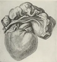 An illustration from A text-book of pathology / by Alfred Stengel ; with 394 illustrations in the text, many of them in colors, and 7 full-page chromolithographic plates. (1903)