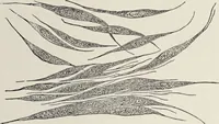 An illustration from A text-book of pathology / by Alfred Stengel ; with 394 illustrations in the text, many of them in colors, and 7 full-page chromolithographic plates. (1903)
