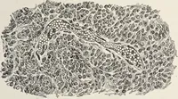 An illustration from A text-book of pathology / by Alfred Stengel ; with 394 illustrations in the text, many of them in colors, and 7 full-page chromolithographic plates. (1903)