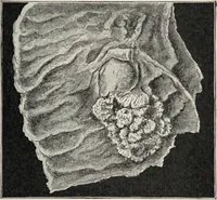 Picture 34 of 178 from A text-book of pathology / by Alfred Stengel ; with 394 illustrations in the text, many of them in colors, and 7 full-page chromolithographic plates. (1903), leaf 185