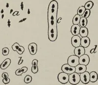 An illustration from A text-book of pathology / by Alfred Stengel ; with 394 illustrations in the text, many of them in colors, and 7 full-page chromolithographic plates. (1903)