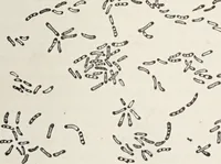 An illustration from A text-book of pathology / by Alfred Stengel ; with 394 illustrations in the text, many of them in colors, and 7 full-page chromolithographic plates. (1903)