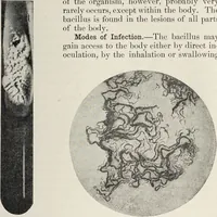 Picture 44 of 178 from A text-book of pathology / by Alfred Stengel ; with 394 illustrations in the text, many of them in colors, and 7 full-page chromolithographic plates. (1903), leaf 253