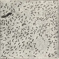 An illustration from A text-book of pathology / by Alfred Stengel ; with 394 illustrations in the text, many of them in colors, and 7 full-page chromolithographic plates. (1903)