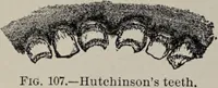 Picture 50 of 178 from A text-book of pathology / by Alfred Stengel ; with 394 illustrations in the text, many of them in colors, and 7 full-page chromolithographic plates. (1903), leaf 292