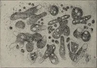 An illustration from A text-book of pathology / by Alfred Stengel ; with 394 illustrations in the text, many of them in colors, and 7 full-page chromolithographic plates. (1903)
