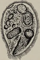 An illustration from A text-book of pathology / by Alfred Stengel ; with 394 illustrations in the text, many of them in colors, and 7 full-page chromolithographic plates. (1903)
