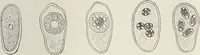 An illustration from A text-book of pathology / by Alfred Stengel ; with 394 illustrations in the text, many of them in colors, and 7 full-page chromolithographic plates. (1903)