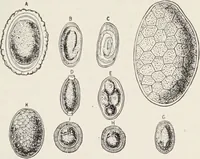 An illustration from A text-book of pathology / by Alfred Stengel ; with 394 illustrations in the text, many of them in colors, and 7 full-page chromolithographic plates. (1903)