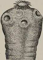 An illustration from A text-book of pathology / by Alfred Stengel ; with 394 illustrations in the text, many of them in colors, and 7 full-page chromolithographic plates. (1903)