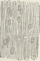 An illustration from A text-book of pathology / by Alfred Stengel ; with 394 illustrations in the text, many of them in colors, and 7 full-page chromolithographic plates. (1903)