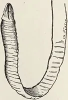 An illustration from A text-book of pathology / by Alfred Stengel ; with 394 illustrations in the text, many of them in colors, and 7 full-page chromolithographic plates. (1903)