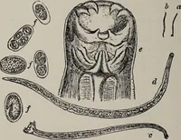 An illustration from A text-book of pathology / by Alfred Stengel ; with 394 illustrations in the text, many of them in colors, and 7 full-page chromolithographic plates. (1903)