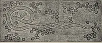 An illustration from A text-book of pathology / by Alfred Stengel ; with 394 illustrations in the text, many of them in colors, and 7 full-page chromolithographic plates. (1903)