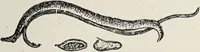 An illustration from A text-book of pathology / by Alfred Stengel ; with 394 illustrations in the text, many of them in colors, and 7 full-page chromolithographic plates. (1903)
