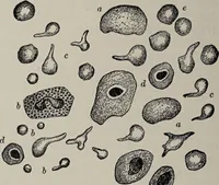 An illustration from A text-book of pathology / by Alfred Stengel ; with 394 illustrations in the text, many of them in colors, and 7 full-page chromolithographic plates. (1903)