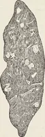 An illustration from A text-book of pathology / by Alfred Stengel ; with 394 illustrations in the text, many of them in colors, and 7 full-page chromolithographic plates. (1903)