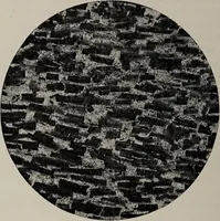 An illustration from A text-book of pathology / by Alfred Stengel ; with 394 illustrations in the text, many of them in colors, and 7 full-page chromolithographic plates. (1903)