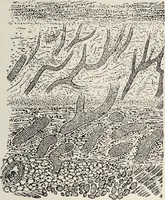 An illustration from A text-book of pathology / by Alfred Stengel ; with 394 illustrations in the text, many of them in colors, and 7 full-page chromolithographic plates. (1903)