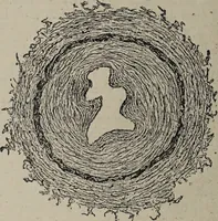 An illustration from A text-book of pathology / by Alfred Stengel ; with 394 illustrations in the text, many of them in colors, and 7 full-page chromolithographic plates. (1903)