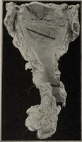 Picture 101 of 178 from A text-book of pathology / by Alfred Stengel ; with 394 illustrations in the text, many of them in colors, and 7 full-page chromolithographic plates. (1903), leaf 454