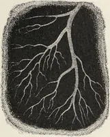 An illustration from A text-book of pathology / by Alfred Stengel ; with 394 illustrations in the text, many of them in colors, and 7 full-page chromolithographic plates. (1903)