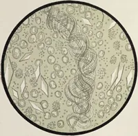 An illustration from A text-book of pathology / by Alfred Stengel ; with 394 illustrations in the text, many of them in colors, and 7 full-page chromolithographic plates. (1903)