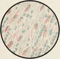 An illustration from A text-book of pathology / by Alfred Stengel ; with 394 illustrations in the text, many of them in colors, and 7 full-page chromolithographic plates. (1903)