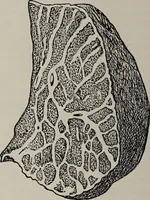 An illustration from A text-book of pathology / by Alfred Stengel ; with 394 illustrations in the text, many of them in colors, and 7 full-page chromolithographic plates. (1903)