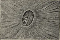An illustration from A text-book of pathology / by Alfred Stengel ; with 394 illustrations in the text, many of them in colors, and 7 full-page chromolithographic plates. (1903)
