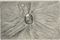 An illustration from A text-book of pathology / by Alfred Stengel ; with 394 illustrations in the text, many of them in colors, and 7 full-page chromolithographic plates. (1903)
