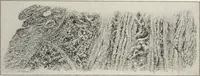 An illustration from A text-book of pathology / by Alfred Stengel ; with 394 illustrations in the text, many of them in colors, and 7 full-page chromolithographic plates. (1903)