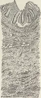 An illustration from A text-book of pathology / by Alfred Stengel ; with 394 illustrations in the text, many of them in colors, and 7 full-page chromolithographic plates. (1903)