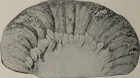 An illustration from A text-book of pathology / by Alfred Stengel ; with 394 illustrations in the text, many of them in colors, and 7 full-page chromolithographic plates. (1903)