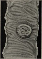 An illustration from A text-book of pathology / by Alfred Stengel ; with 394 illustrations in the text, many of them in colors, and 7 full-page chromolithographic plates. (1903)