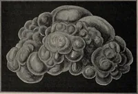 An illustration from A text-book of pathology / by Alfred Stengel ; with 394 illustrations in the text, many of them in colors, and 7 full-page chromolithographic plates. (1903)