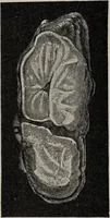 Picture 129 of 178 from A text-book of pathology / by Alfred Stengel ; with 394 illustrations in the text, many of them in colors, and 7 full-page chromolithographic plates. (1903), leaf 632