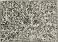 An illustration from A text-book of pathology / by Alfred Stengel ; with 394 illustrations in the text, many of them in colors, and 7 full-page chromolithographic plates. (1903)
