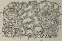 An illustration from A text-book of pathology / by Alfred Stengel ; with 394 illustrations in the text, many of them in colors, and 7 full-page chromolithographic plates. (1903)