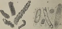 An illustration from A text-book of pathology / by Alfred Stengel ; with 394 illustrations in the text, many of them in colors, and 7 full-page chromolithographic plates. (1903)