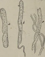 An illustration from A text-book of pathology / by Alfred Stengel ; with 394 illustrations in the text, many of them in colors, and 7 full-page chromolithographic plates. (1903)